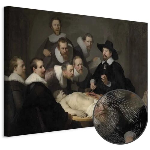  Slika - Rembrandt &ndash; The Anatomy Lesson of Dr. Tulp 30x20 Premium Print Cijene