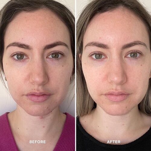 Alpha-H Vitamin B serum 25 ml Slike