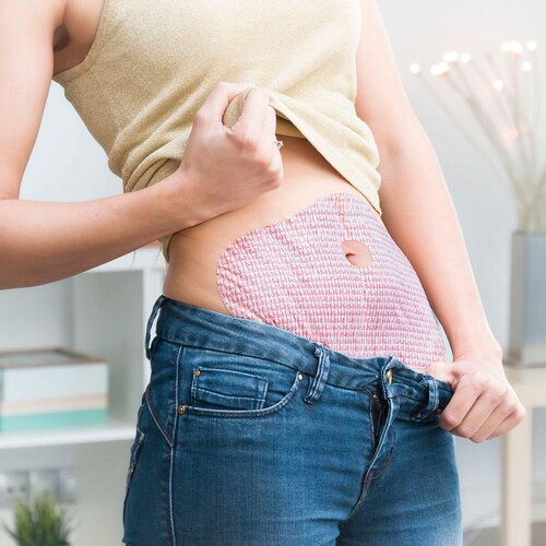 InnovaGoods Flasteri za Mršavljenje s Biljnim Ekstraktima Fithes 5 kom. Cijene