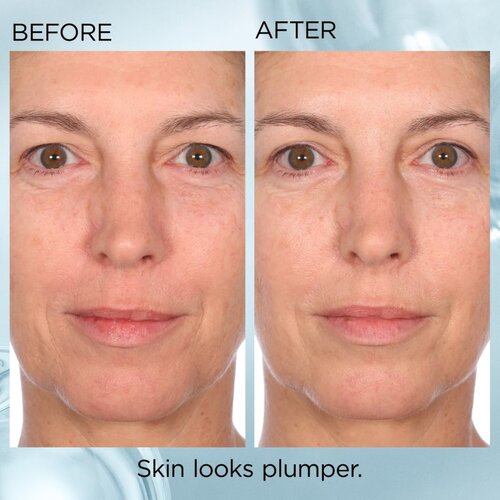Elizabeth Arden Ceramide Hyaluronic Acid + Peptides serum za obraz v kapsulah s ceramidy a peptidy 60 caps. Slike