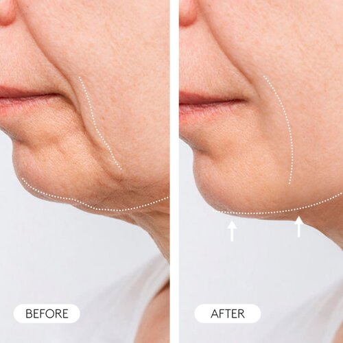 Cocunat Clinical Molecular Therapy učvrstitvena krema proti staranju 50 ml Slike