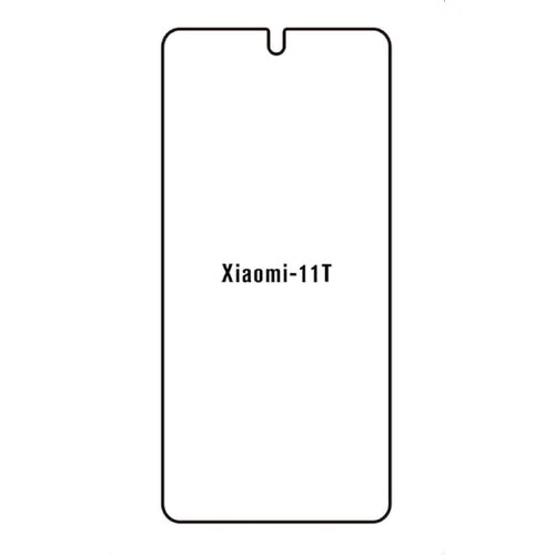 Xiaomi MI 11T HYDROGEL ZAŠTITNA FOLIJA Cijene