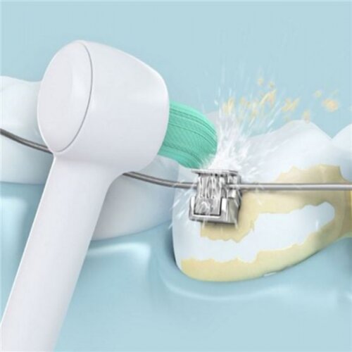  WEW 0984 W 303 Orthodontische Düse - zamjenska mlaznica Cijene