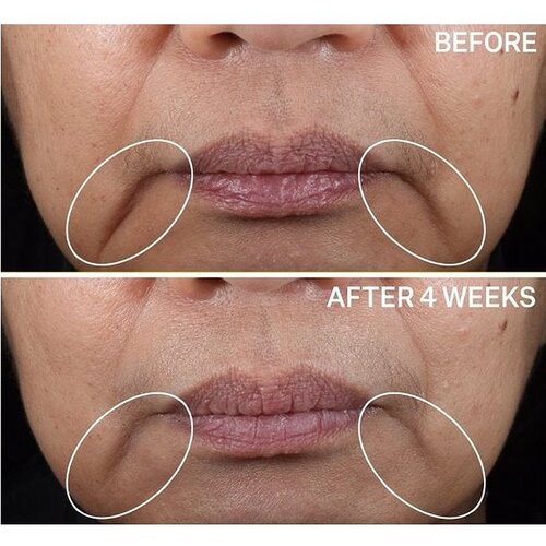 StriVectin Contour Restore&amp;trade; Tightening &amp;amp; Sculpting Face Cream ultra lifting krema za obraz 50 ml Slike