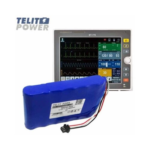 Telit Power baterija li-ion 11.1v 5800mah lg( p-2397 ) za bitos bt-740 pacijent monitor Slike