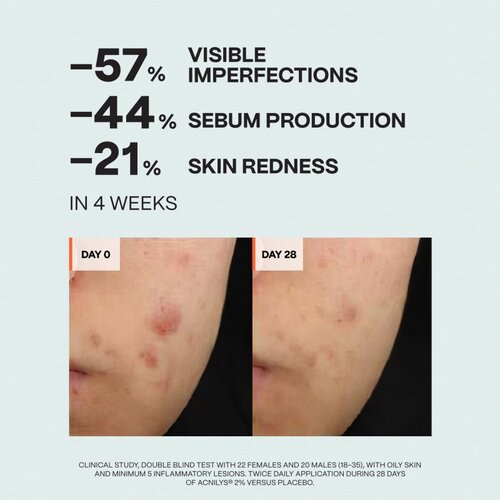 Saffee ClearDerm Day &amp;amp; Night Care Set set za problematično lice Slike