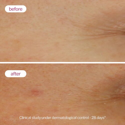 Novexpert Booster serum sa hijaluronskom kiselinom 3,2% &amp;ndash; Ultra hidratacija Slike