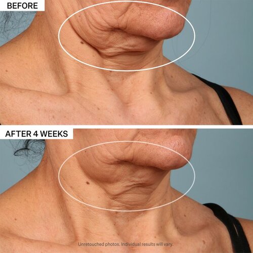StriVectin Tighten & Lift TL Advanced Tightening Neck Cream Plus krema za vrat i dekolte za sve vrste kože 30 ml Cene
