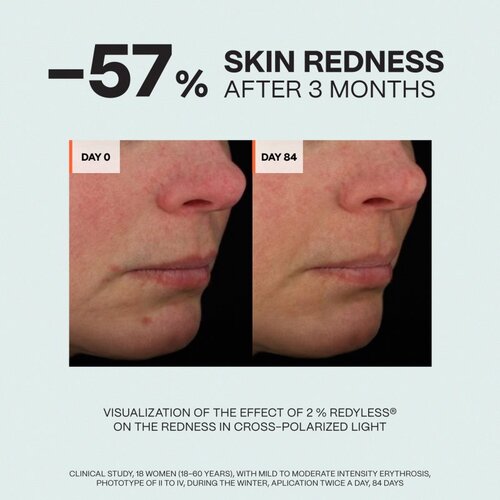 Saffee SensiDerm Soothing Relief Cream umirujuća krema za suhu i osjetljivu kožu 50 ml Slike