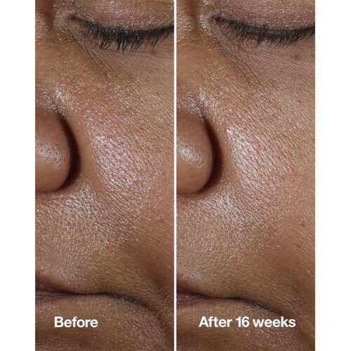 Clinique Smart Clinical&amp;trade; Repair Wrinke Correcting Serum serum za obraz za korekcijo gub 100 ml Slike