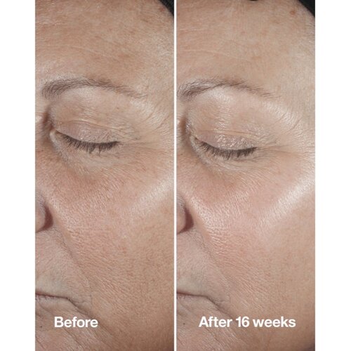 Clinique Smart Clinical&amp;trade; Repair Wrinke Correcting Serum serum za lice za korekciju bora 100 ml Slike