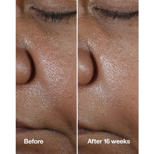 Clinique Smart Clinical&amp;trade; Repair Wrinke Correcting Serum serum za lice za korekciju bora 75 ml Slike