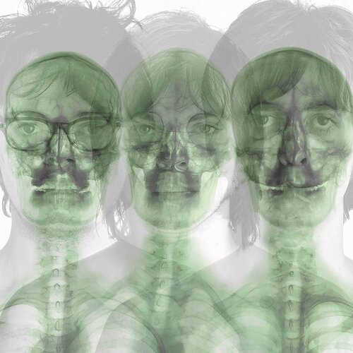 Supergrass (Black Heavy Weight Vinyl) (Remastered) Cene