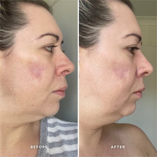 Alpha-H Vitamin A serum s vitaminom A 25 ml Slike