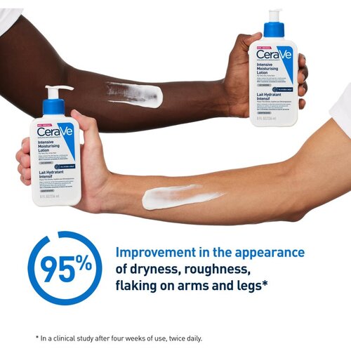 CeraVe Moisturizers Intensive Moisturizing Lotion vlažilni losjon za suho in srbečo kožo 473 ml Slike