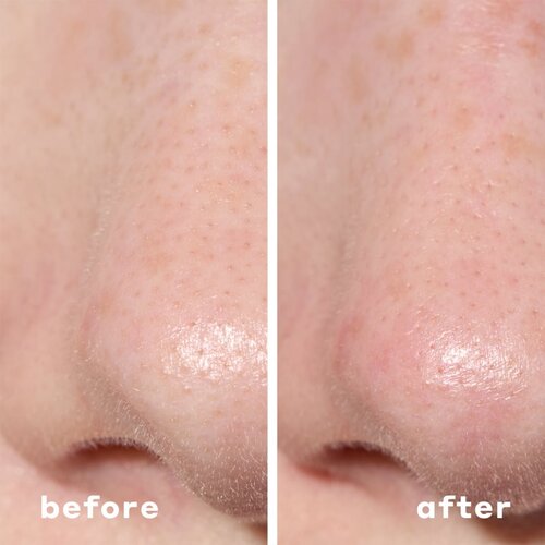 Mario Badescu 2-in-1 Deep Cleansing Pore Strip flasteri za problematičnu kožu lica 2 u 1 6 kom Slike