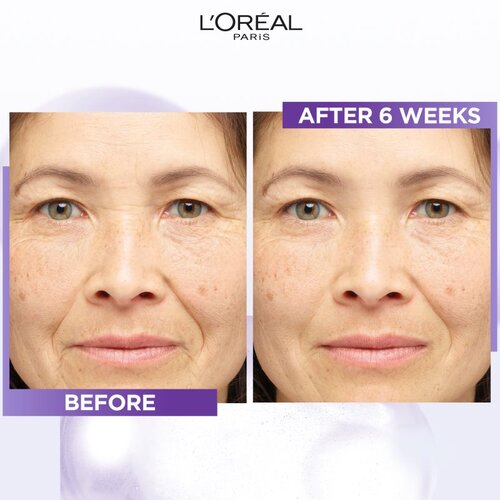 L&amp;acute;Or&amp;eacute;al Paris Revitalift Filler serum proti gubam s hialuronsko kislino 15 ml Slike