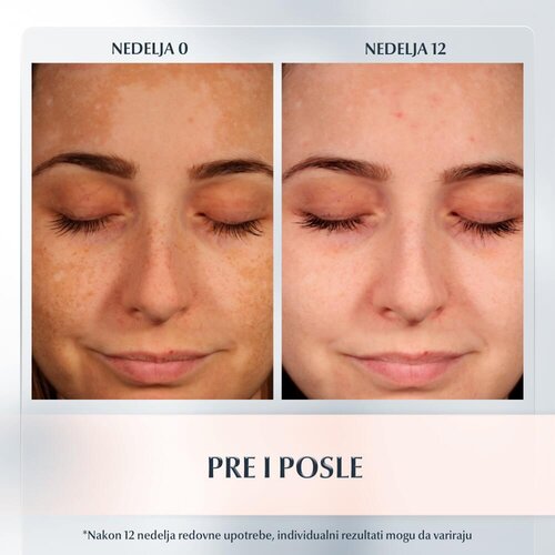 Eucerin Anti-Pigment lokalna korektivna njega protiv pigmentnih mrlja 5 ml Slike