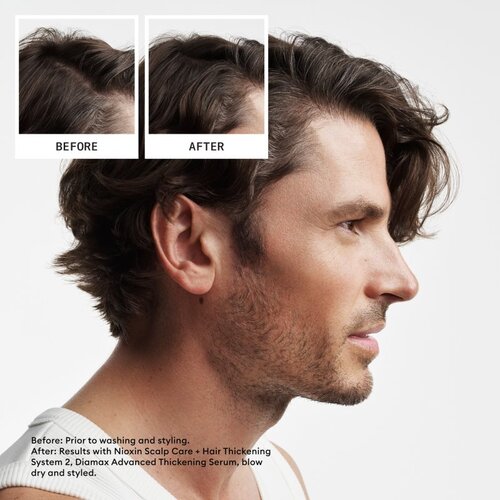 Nioxin System 2 Scalp Therapy darilni set za redke lase 3 kos Slike