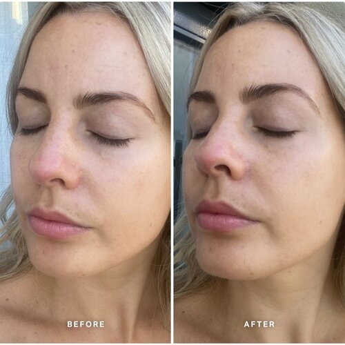 Alpha-H Vitamin E umirujući serum s vitaminom E 25 ml Slike