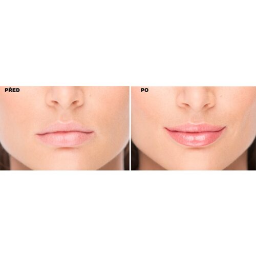FacEvolution LipPlus Booster nega za povečanje volumna ustnic odtenek Transparent 5 ml Slike