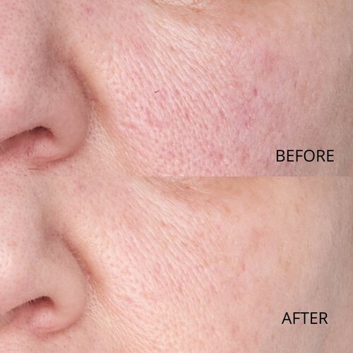 Perricone MD Hypoallergenic Clean Correction Smoothing Restorative Serum gladilni serum za hidracijo in posvetlitev kože 59 ml Slike