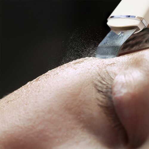 Rio Ultrasonic Skin Cleanser večfunkcijska ultrazvočna lopatka 1 kos Slike
