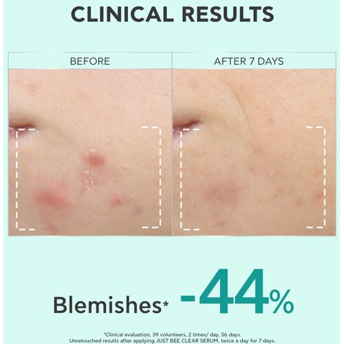 Apivita Just Bee Clear Serum serum za masnu i problematičnu kožu 30 ml Slike