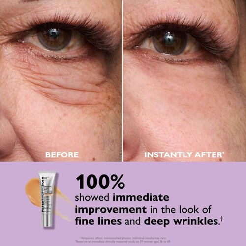 Peter Thomas Roth Instant FIRMx Eye krema za područje oko očiju za pomlađivanje lica 20 ml Slike