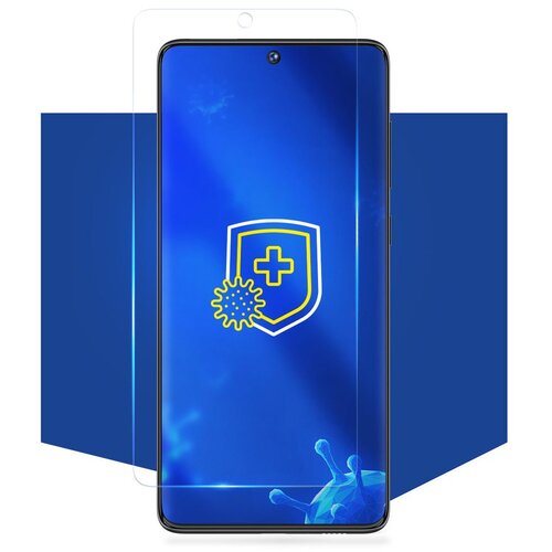 3mk Silver Protect Plus antimikrobna folija za Xiaomi Mi 11 Ultra 5G Slike