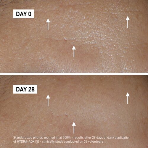 Filorga HYDRA-AOX intenzivni serum z antioksidacijskim učinkom 30 ml Slike