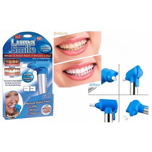 Aparat za poliranje i izbeljivanje zuba - luma smile Slike