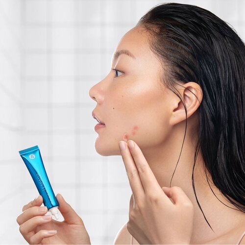 Foreo Espada BHA+PHA Blemish Solution lokalni gel za akne 15 ml Slike