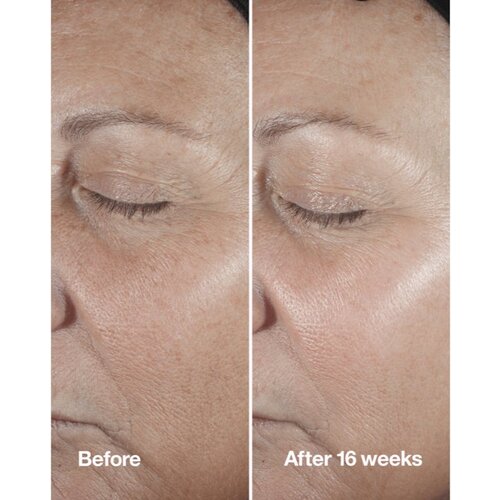 Clinique Smart Clinical&amp;trade; Repair Wrinke Correcting Serum serum za lice za korekciju bora 75 ml Slike