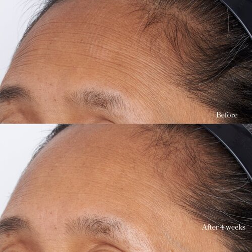 Perricone MD High Potency intenzivna vlažilna maska za obraz s hialuronsko kislino 59 ml Slike