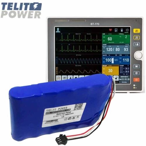 Telit Power Baterija Li-Ion 11.1V 5800mAh LG za BITOS BT-740 pacijent monitor Cene