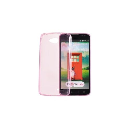  Futrola candy case slim 0.3mm Samsung J530 J5 2017 pink Cijene