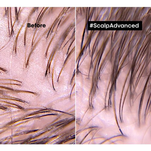 L´Oréal Paris Scalp Advanced Anti-Oiliness Professional Clay glina za dubinsko čišćenje kose 250 ml za ženske Cijene