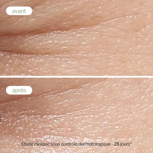 Novexpert Booster serum sa polifenolima zelenog čaja &amp;ndash; protiv tamnih fleka i za blistav ten Slike