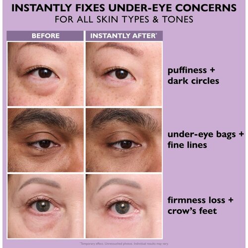 Peter Thomas Roth Instant FIRMx Eye krema za područje oko očiju za pomlađivanje lica 20 ml Slike