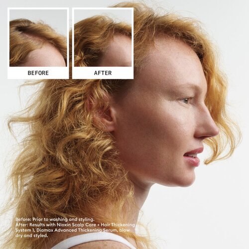 Nioxin Scalp Recovery darilni set za tanke ali redke lase 3 kos Slike