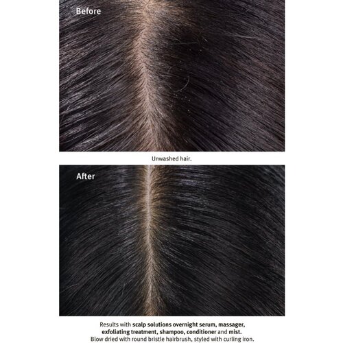 Aveda Scalp Solutions Replenishing Conditioner nežen balzam za prehrano in hidracijo 40 ml Slike