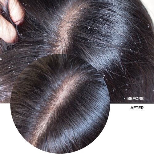 REVOX B77 JUST Hyaluronic Acid 2% for Hair vlažilni serum za lase in lasi&amp;scaron;če 30 ml Slike