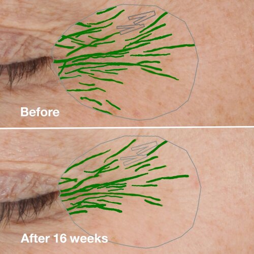 Clinique Smart Clinical&amp;trade; Repair Wrinke Correcting Serum serum za lice za korekciju bora 100 ml Slike