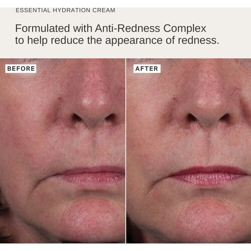 Alpha-H Essential hidratantna krema 50 ml Slike
