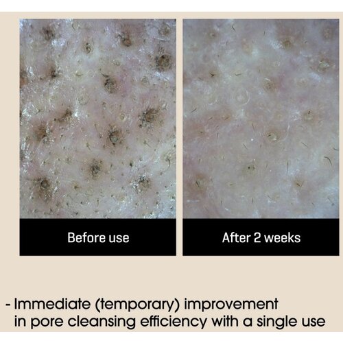SOMEBYMI Lacto Soy Enzyme Deep Cleansing Foam globinsko čistilna pena s pomirjajočim učinkom 100 ml Slike