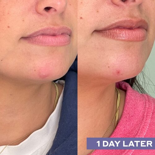 Mario Badescu Repairing Facial Spray With Hypochlorous Acid obnovitveno pr&amp;scaron;ilo za obraz za pomiritev kože 118 ml Slike