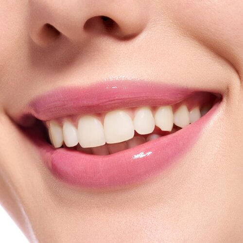Essence Extreme Shine sjajilo za usne za veći volumen nijansa 21 Pretty in Pink 5 ml Slike