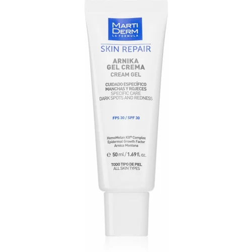 MARTIDERM Skin Repair gel krema protiv tamnih mrlja SPF 30 50 ml