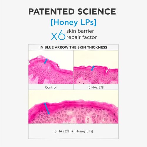 Apivita Bee Tech Concentrates HA5 Honey Repair Serum revitalizirajući serum s hijaluronskom kiselinom 30 ml Slike